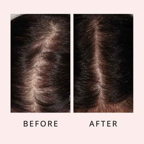 Luxe Hair Growth Serum [BOGO]