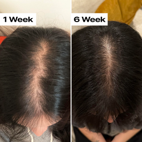 Luxe Micro Needling - v4.png__PID:47bc8563-7826-4a47-aa75-eda5a84310c2